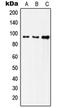 Insulin Receptor antibody, LS-C352396, Lifespan Biosciences, Western Blot image 
