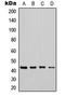 Carbohydrate Sulfotransferase 6 antibody, LS-C354611, Lifespan Biosciences, Western Blot image 