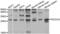 Programmed Cell Death 10 antibody, abx002091, Abbexa, Western Blot image 