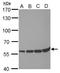 PR domain zinc finger protein 14 antibody, GTX629805, GeneTex, Western Blot image 
