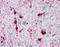 HspB5 antibody, ADI-SPA-223-F, Enzo Life Sciences, Immunohistochemistry paraffin image 