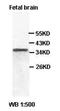 Protein Wnt-8a antibody, orb77195, Biorbyt, Western Blot image 