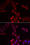 PHS antibody, STJ28475, St John