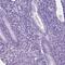 HHIP Like 2 antibody, PA5-63765, Invitrogen Antibodies, Immunohistochemistry frozen image 