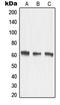 Matrix Metallopeptidase 15 antibody, LS-C352533, Lifespan Biosciences, Western Blot image 