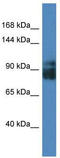 Leucine Rich Repeat Containing 8 VRAC Subunit A antibody, TA331090, Origene, Western Blot image 