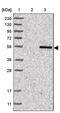 Peroxisomal leader peptide-processing protease antibody, PA5-56435, Invitrogen Antibodies, Western Blot image 