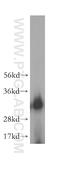 AU RNA Binding Methylglutaconyl-CoA Hydratase antibody, 17079-1-AP, Proteintech Group, Western Blot image 
