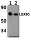 Leukocyte Immunoglobulin Like Receptor B5 antibody, A10961-1, Boster Biological Technology, Western Blot image 