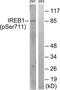 IRP1 antibody, TA311963, Origene, Western Blot image 