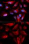 S100 Calcium Binding Protein A11 antibody, GTX33483, GeneTex, Immunofluorescence image 