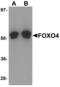 Forkhead Box O4 antibody, LS-B5287, Lifespan Biosciences, Western Blot image 