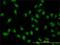 XPA Binding Protein 2 antibody, H00056949-M01, Novus Biologicals, Immunocytochemistry image 