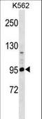 CNR1 antibody, LS-C163419, Lifespan Biosciences, Western Blot image 