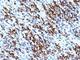 Myogenin antibody, V3139IHC-7ML, NSJ Bioreagents, Immunohistochemistry frozen image 