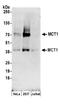 Monocarboxylate transporter 1 antibody, A304-357A, Bethyl Labs, Western Blot image 