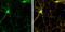 SH3 And Multiple Ankyrin Repeat Domains 2 antibody, GTX133352, GeneTex, Immunocytochemistry image 