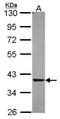 Quinone oxidoreductase PIG3 antibody, GTX105821, GeneTex, Western Blot image 