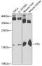 6-Pyruvoyltetrahydropterin Synthase antibody, 22-115, ProSci, Western Blot image 