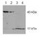 Caspase 2 antibody, AP00010PU-N, Origene, Western Blot image 