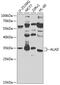 Aminolevulinate Dehydratase antibody, 23-555, ProSci, Western Blot image 
