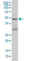 Tumor Susceptibility 101 antibody, LS-B5547, Lifespan Biosciences, Western Blot image 