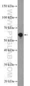 Alkylglycerol Monooxygenase antibody, 21355-1-AP, Proteintech Group, Western Blot image 