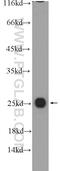 Cytochrome C Oxidase Assembly Factor 7 (Putative) antibody, 25361-1-AP, Proteintech Group, Western Blot image 