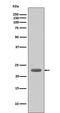 BCL2 Like 11 antibody, M01552, Boster Biological Technology, Western Blot image 