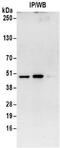 Isocitrate dehydrogenase [NAD] subunit gamma 1, mitochondrial antibody, NBP2-32150, Novus Biologicals, Immunoprecipitation image 