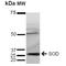 Superoxide Dismutase 3 antibody, PA5-77814, Invitrogen Antibodies, Western Blot image 