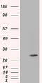 Cilia And Flagella Associated Protein 298 antibody, TA501348, Origene, Western Blot image 