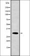 Potassium Calcium-Activated Channel Subfamily M Regulatory Beta Subunit 3 antibody, orb338098, Biorbyt, Western Blot image 