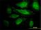 Cdk5 And Abl Enzyme Substrate 1 antibody, H00091768-B01P, Novus Biologicals, Immunofluorescence image 