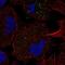 Fibroblast Growth Factor Receptor Like 1 antibody, NBP2-56879, Novus Biologicals, Immunocytochemistry image 
