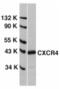 C-X-C Motif Chemokine Receptor 4 antibody, AHP442, Bio-Rad (formerly AbD Serotec) , Immunohistochemistry frozen image 