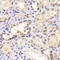 Proteasome 26S Subunit, ATPase 6 antibody, LS-C334023, Lifespan Biosciences, Immunohistochemistry paraffin image 