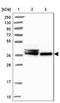 SWI5 Dependent Homologous Recombination Repair Protein 1 antibody, NBP1-90797, Novus Biologicals, Western Blot image 