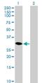 Hydroxysteroid 17-Beta Dehydrogenase 14 antibody, H00051171-B01P, Novus Biologicals, Western Blot image 