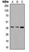 Aldolase, Fructose-Bisphosphate C antibody, orb235007, Biorbyt, Western Blot image 