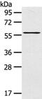 LIM Domain Containing Preferred Translocation Partner In Lipoma antibody, PA5-50885, Invitrogen Antibodies, Western Blot image 