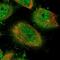 Latent membrane protein 1 antibody, NBP1-80753, Novus Biologicals, Immunofluorescence image 