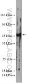 Probable lysosomal cobalamin transporter antibody, 27203-1-AP, Proteintech Group, Western Blot image 