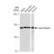 Leptin Receptor antibody, GTX02830, GeneTex, Western Blot image 