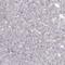 S100 Calcium Binding Protein B antibody, HPA015768, Atlas Antibodies, Immunohistochemistry paraffin image 