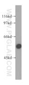 Solute Carrier Family 30 Member 6 antibody, 13526-1-AP, Proteintech Group, Western Blot image 