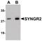 Synaptogyrin 2 antibody, PA5-20877, Invitrogen Antibodies, Western Blot image 