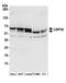 Inactive ubiquitin-specific peptidase 39 antibody, A304-817A, Bethyl Labs, Western Blot image 