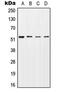 Serine/Threonine Kinase 11 antibody, GTX32269, GeneTex, Western Blot image 