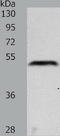 Phosphatidylinositol-3,4,5-trisphosphate 3-phosphatase and dual-specificity protein phosphatase PTEN antibody, TA323701, Origene, Western Blot image 